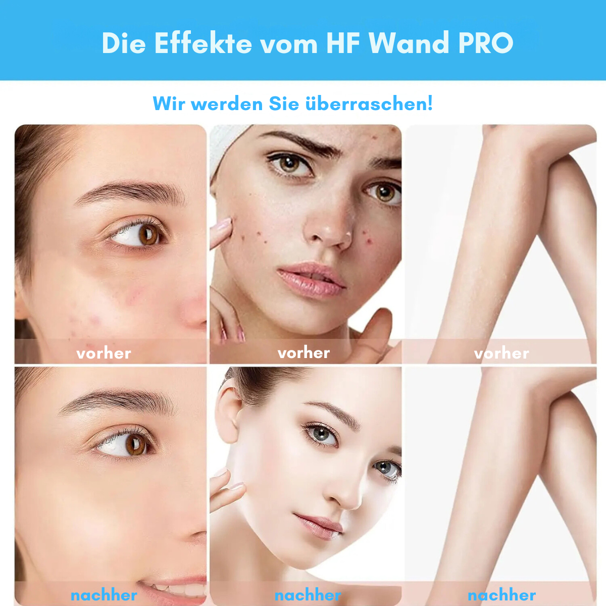 HF Wand PRO